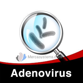 Tratamiento contra Adenovirus (Adenocoli - enfermedad de la paloma jóven)