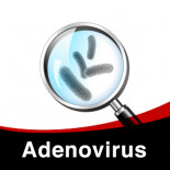 Tratamiento contra Adenovirus (Adenocoli - enfermedad de la paloma jóven)