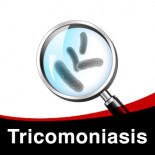 Tratamiento contra Tricomoniasis en Palomas